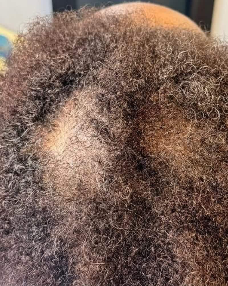 Before — Crown thinning filled in with zero-chemical care