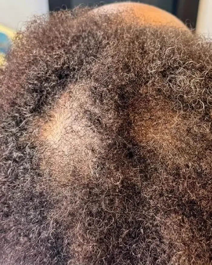 Before — Crown thinning filled in with zero-chemical care